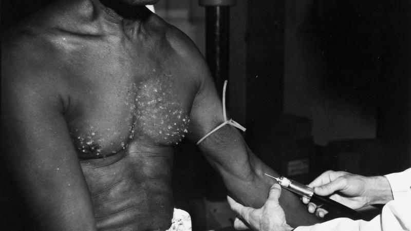 The U.S. government did syphilis experiments on African Americans without their consent