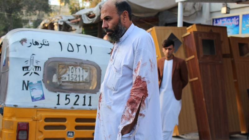 An Afghan wounded man walks to hospital following mosque bombing