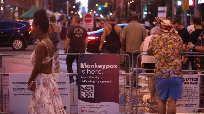 Signs from Toronto Public Health offer resources and information for Monkey Pox