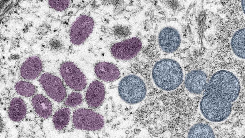 A microscopic view of the monkeypox virus