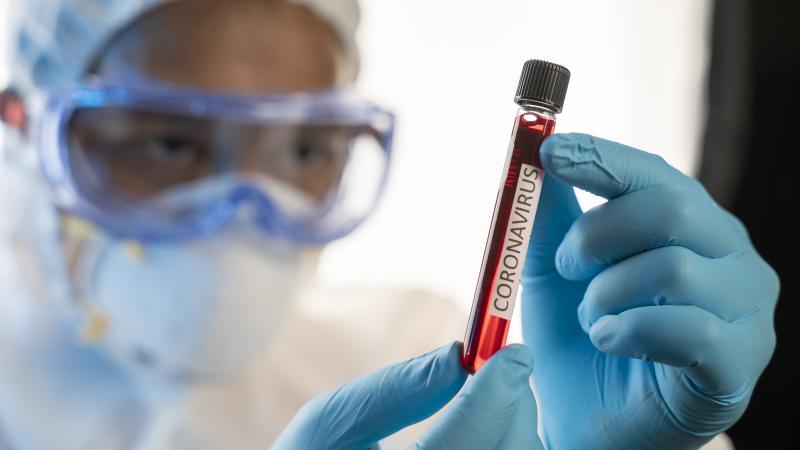 COVID-19 concept photo 