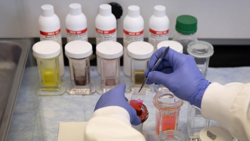 Rita Roberts does research on skin wound healing in a lab in the Department of Kinesiology and Nutrition at the University of Illinois Chicago on March 05, 2025 in Chicago, Illinois. Researchers at universities around the country, who rely on federal grants from the National Institutes of Health to fund their research, are concerned about the future of their projects after the Trump administration cut funding for indirect costs that help universities to operate the research labs. 